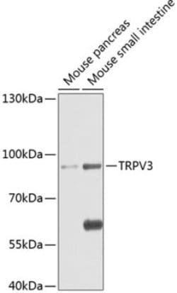AdipoR1 Rabbit anti-Human, Mouse, Rat, Polyclonal, Novus Biologicals 20